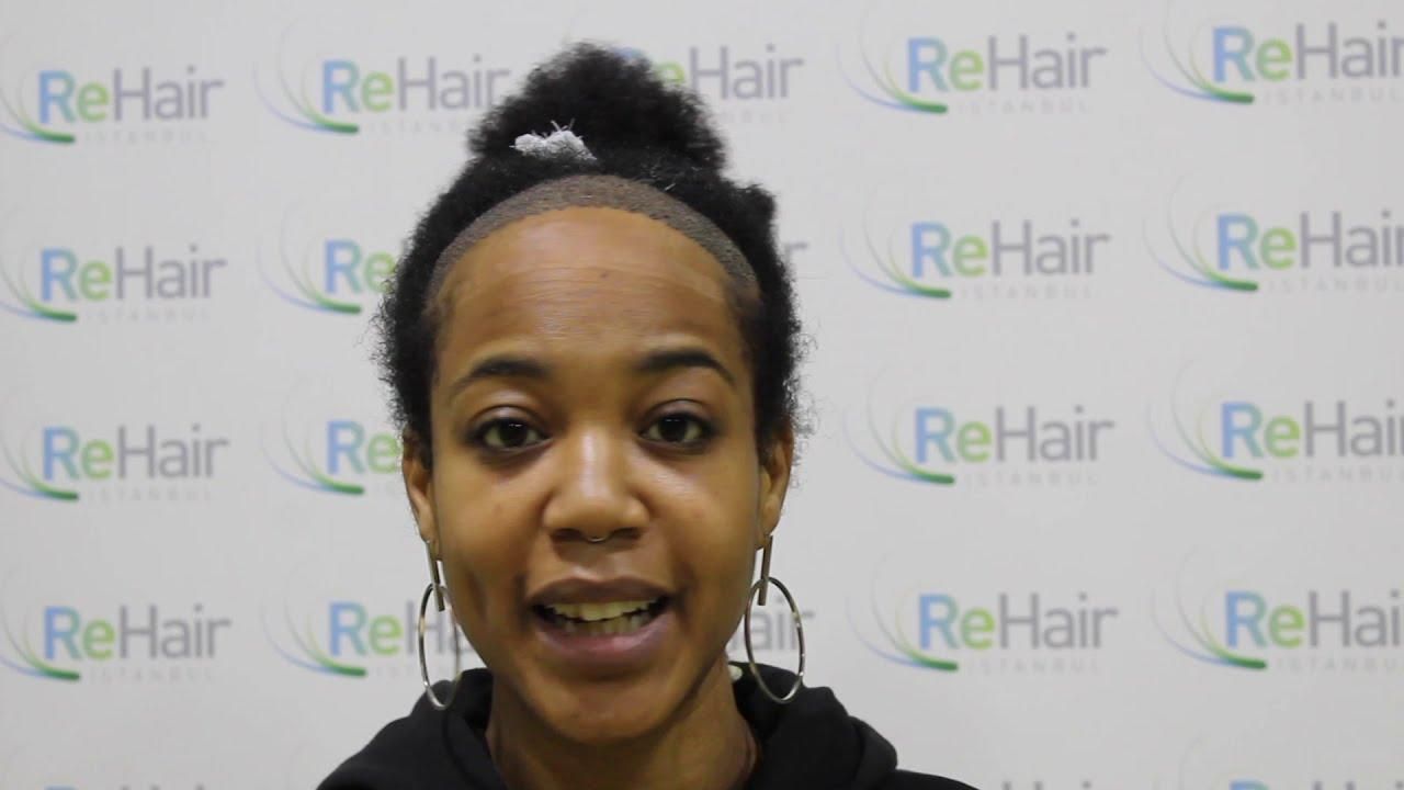 ReHair Istanbul Review - Haartransplantatie voor Vrouwen in Istanbul, Turkije -