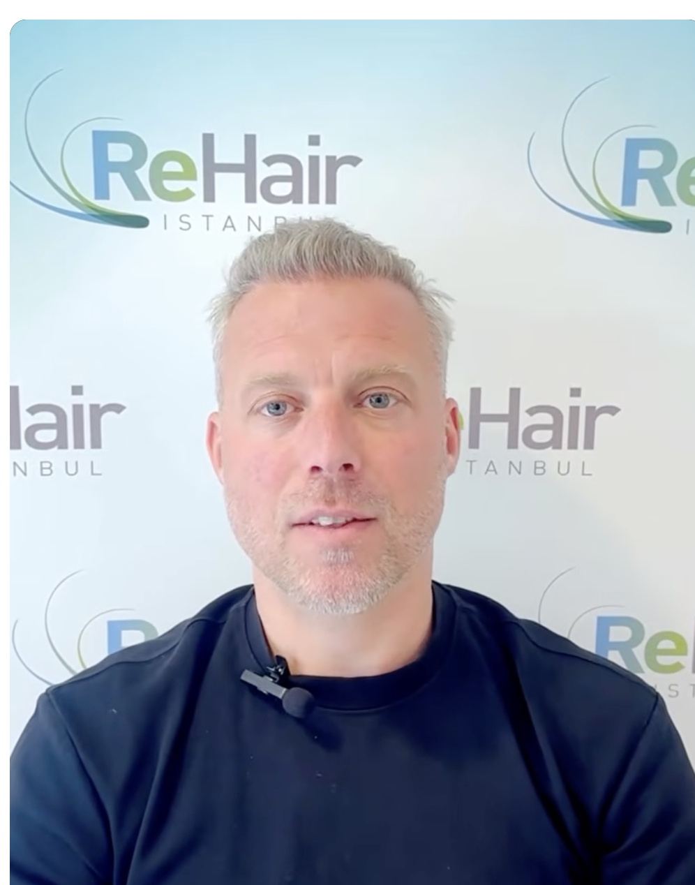 ReHair Istanbul Review | Haartransplantatie in Turkije, İstanbul